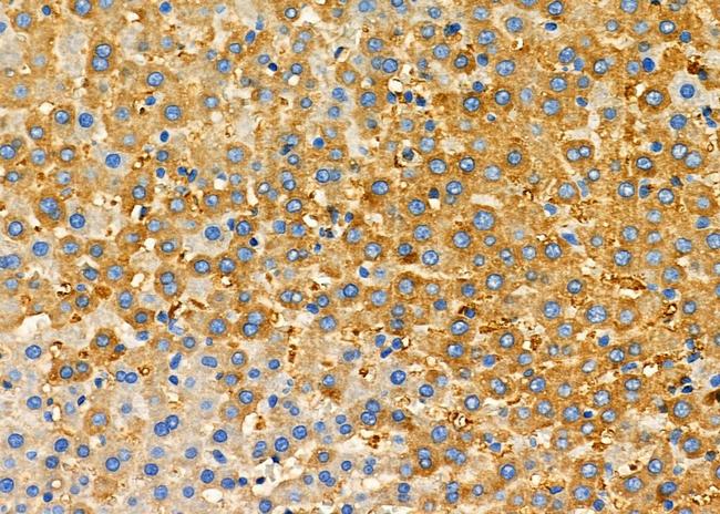 CPOX Antibody in Immunohistochemistry (Paraffin) (IHC (P))