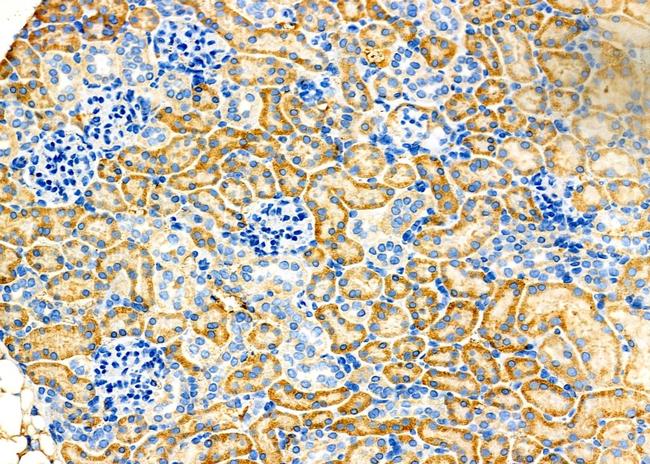 Cytohesin 2 Antibody in Immunohistochemistry (Paraffin) (IHC (P))