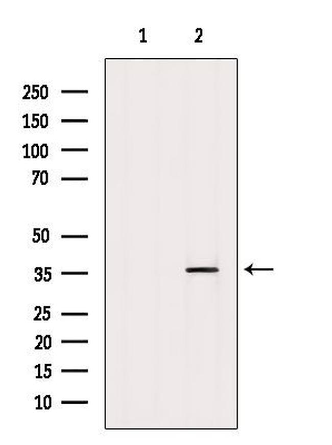 EXOSC8 Antibody in Western Blot (WB)