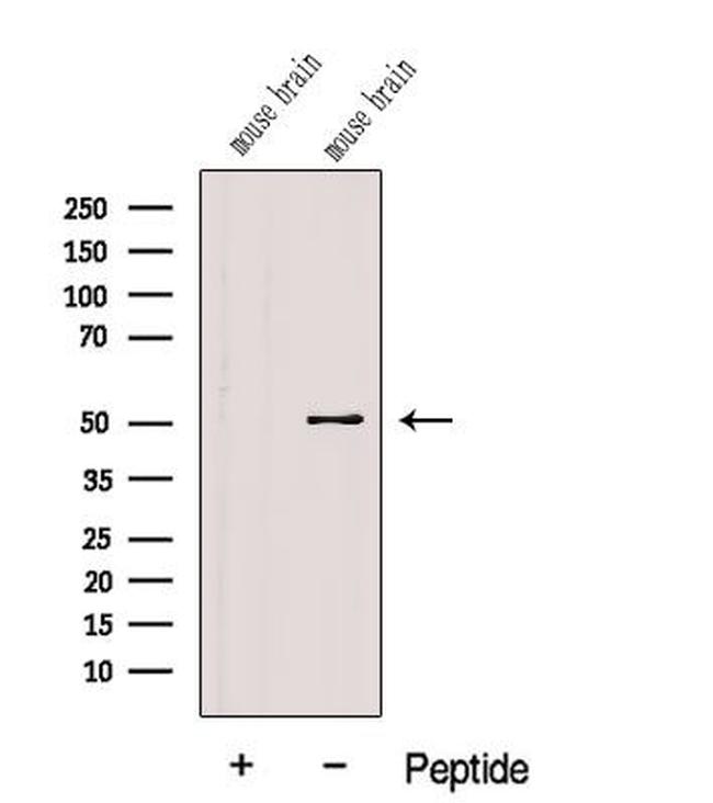 FADS1 Antibody in Western Blot (WB)