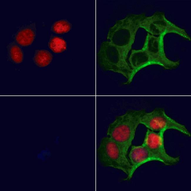 Folliculin Antibody in Immunocytochemistry (ICC/IF)