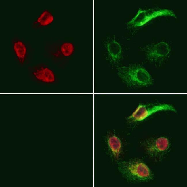 GNAQ Antibody in Immunocytochemistry (ICC/IF)