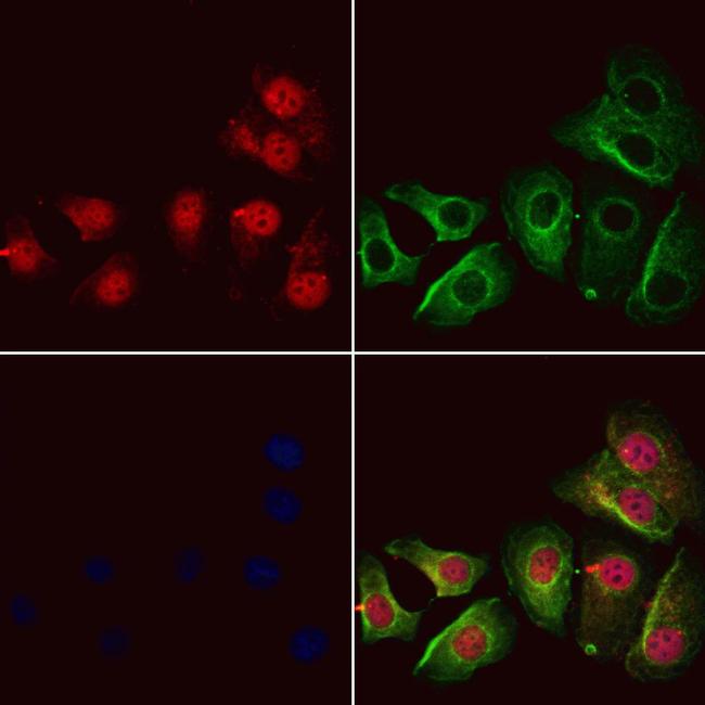 GSTZ1 Antibody in Immunocytochemistry (ICC/IF)