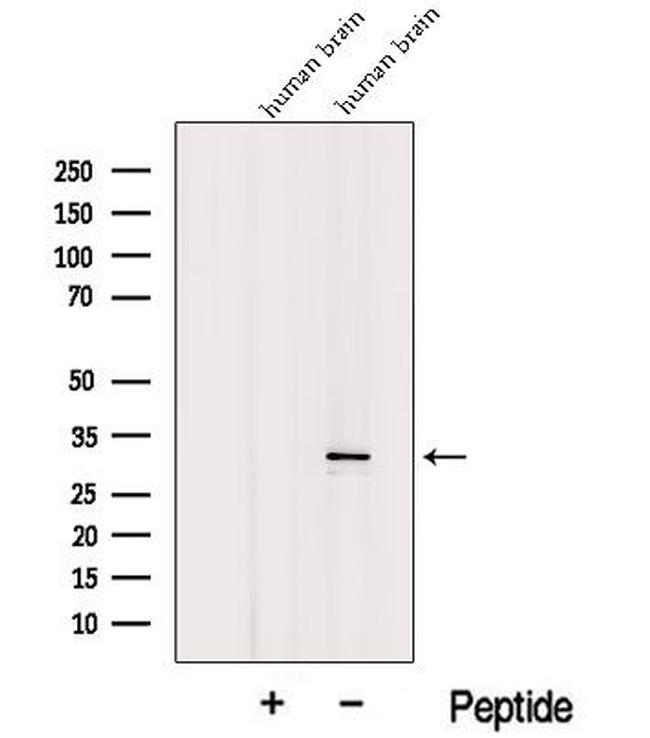 ICMT Antibody in Western Blot (WB)