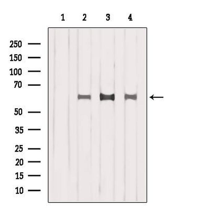 ISYNA1 Antibody in Western Blot (WB)