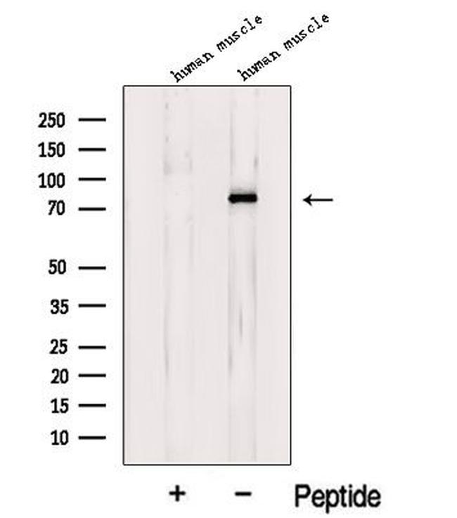 LDB3 Antibody in Western Blot (WB)