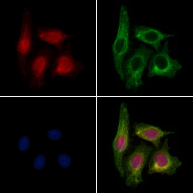 MED12 Antibody in Immunocytochemistry (ICC/IF)