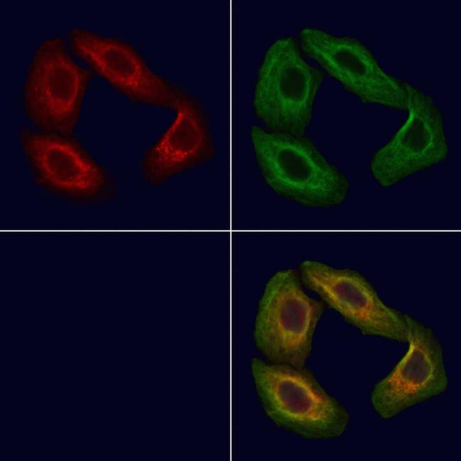 POMGNT1 Antibody in Immunocytochemistry (ICC/IF)