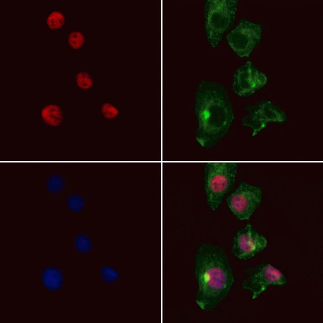 PHD3 Antibody in Immunocytochemistry (ICC/IF)