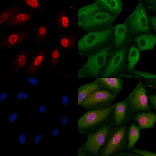 PRUNE2 Antibody in Immunocytochemistry (ICC/IF)