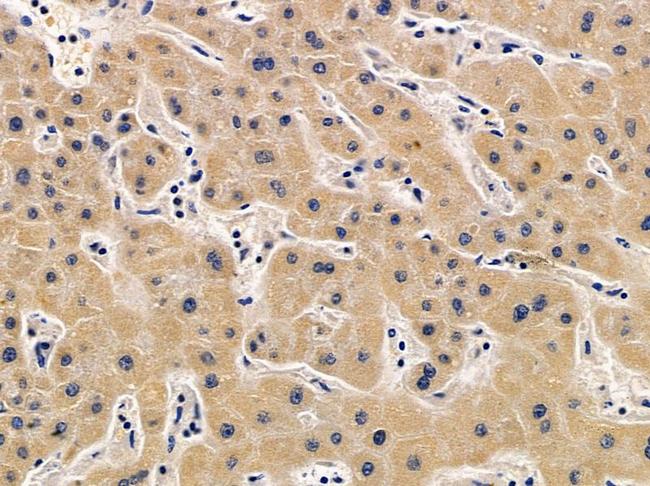 PTPRS Antibody in Immunohistochemistry (Paraffin) (IHC (P))