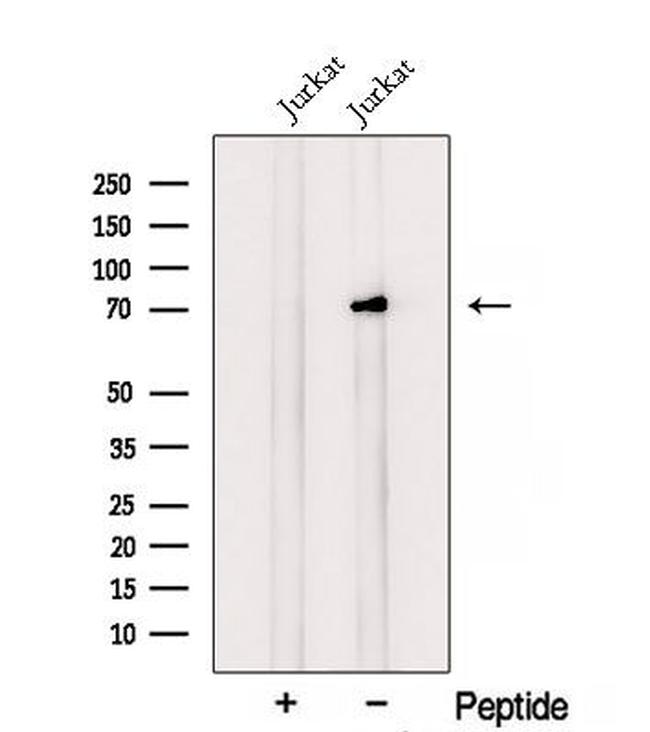 RNF12 Antibody in Western Blot (WB)