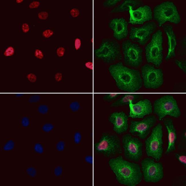 RNaseH2C Antibody in Immunocytochemistry (ICC/IF)