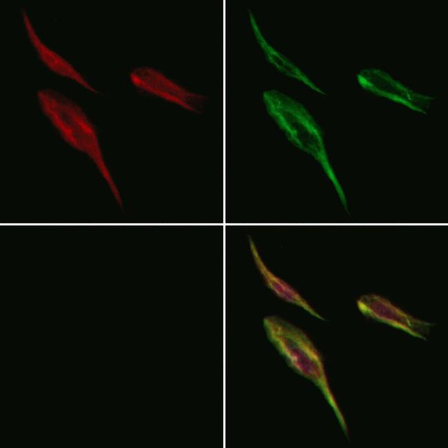 RPN1 Antibody in Immunocytochemistry (ICC/IF)