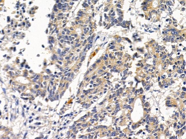 SCO2 Antibody in Immunohistochemistry (Paraffin) (IHC (P))