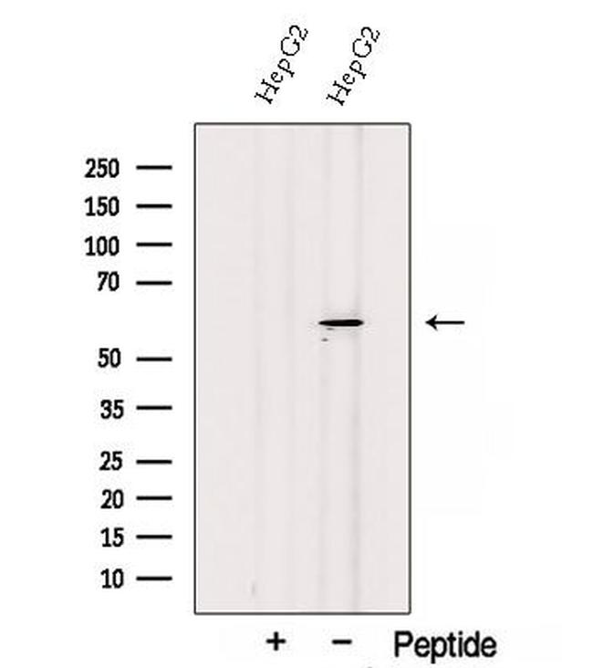 SESN3 Antibody in Western Blot (WB)