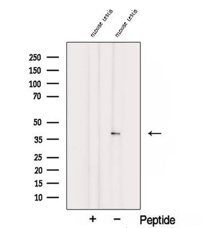 SPATA22 Antibody in Western Blot (WB)