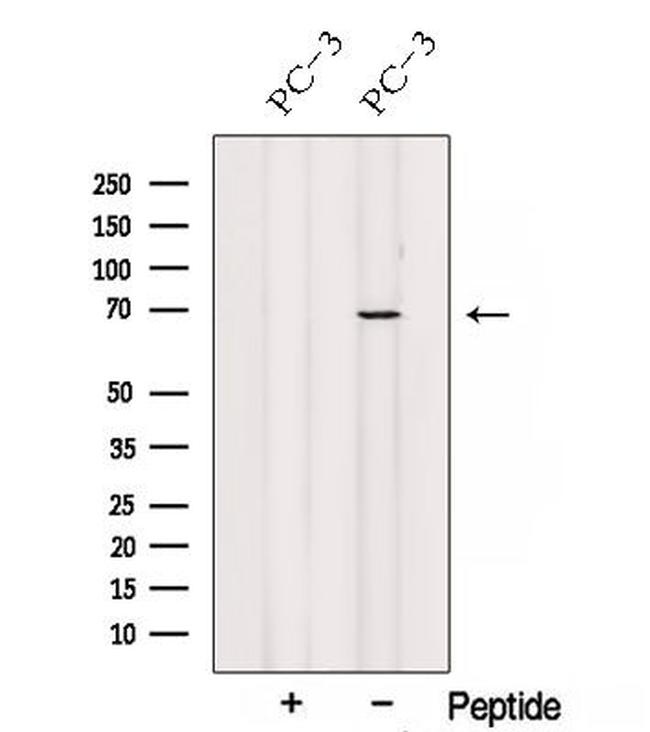 SPATA7 Antibody in Western Blot (WB)