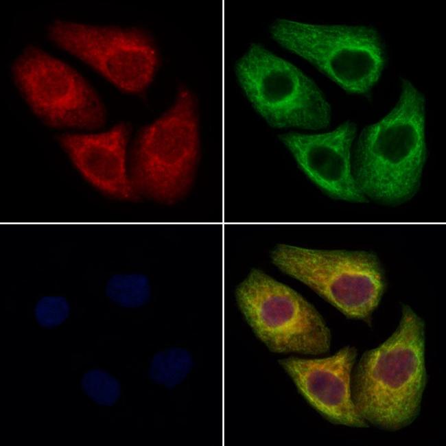 TBCE Antibody in Immunocytochemistry (ICC/IF)