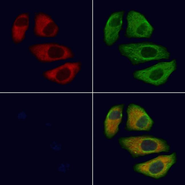 TRPC1 Antibody in Immunocytochemistry (ICC/IF)