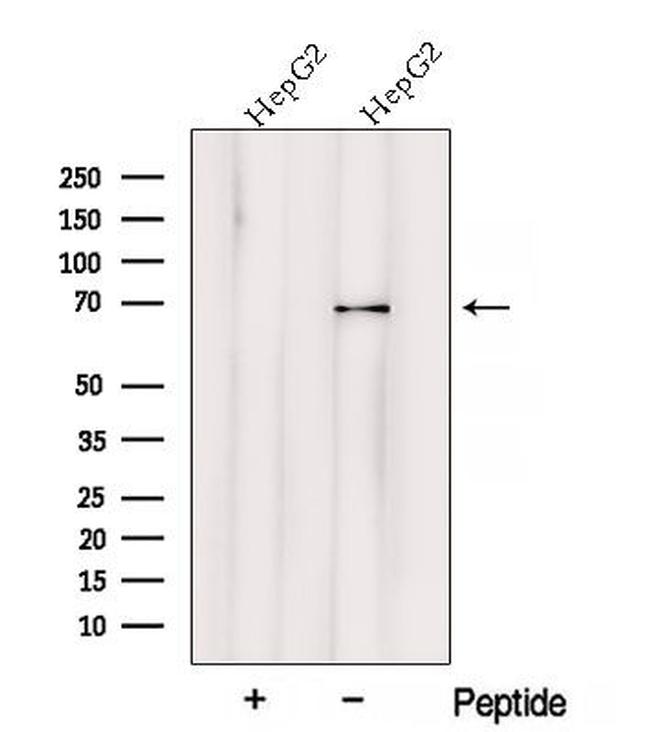 VPS33A Antibody in Western Blot (WB)