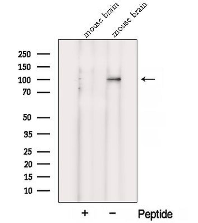 VPS39 Antibody in Western Blot (WB)