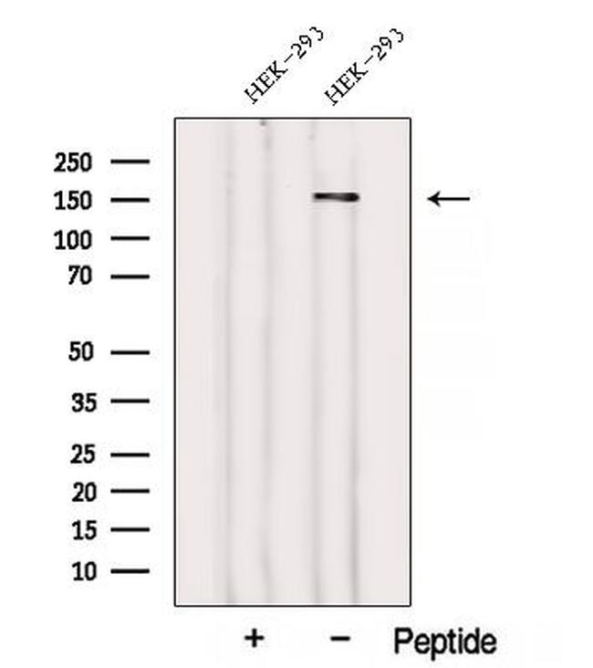 WDR19 Antibody in Western Blot (WB)