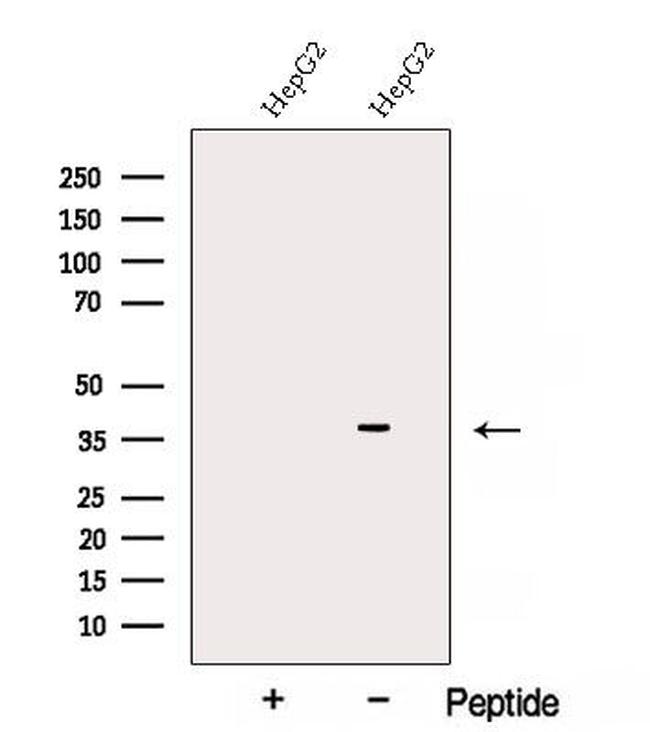 AKR7A3 Antibody in Western Blot (WB)