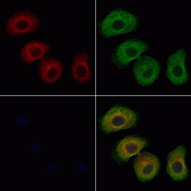 ARHGAP21 Antibody in Immunocytochemistry (ICC/IF)