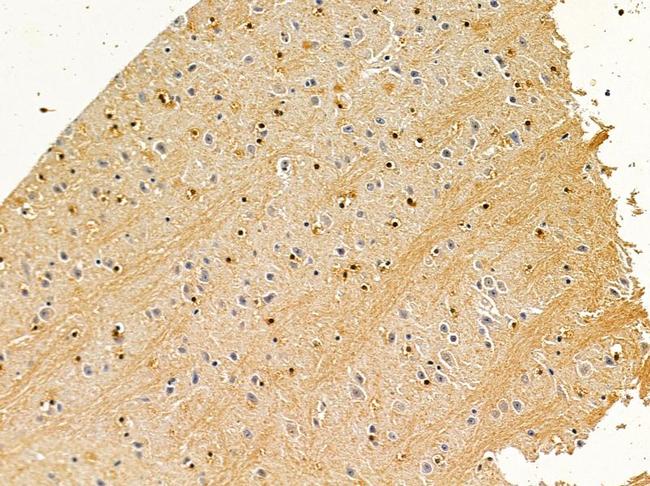 Aspartoacylase Antibody in Immunohistochemistry (Paraffin) (IHC (P))