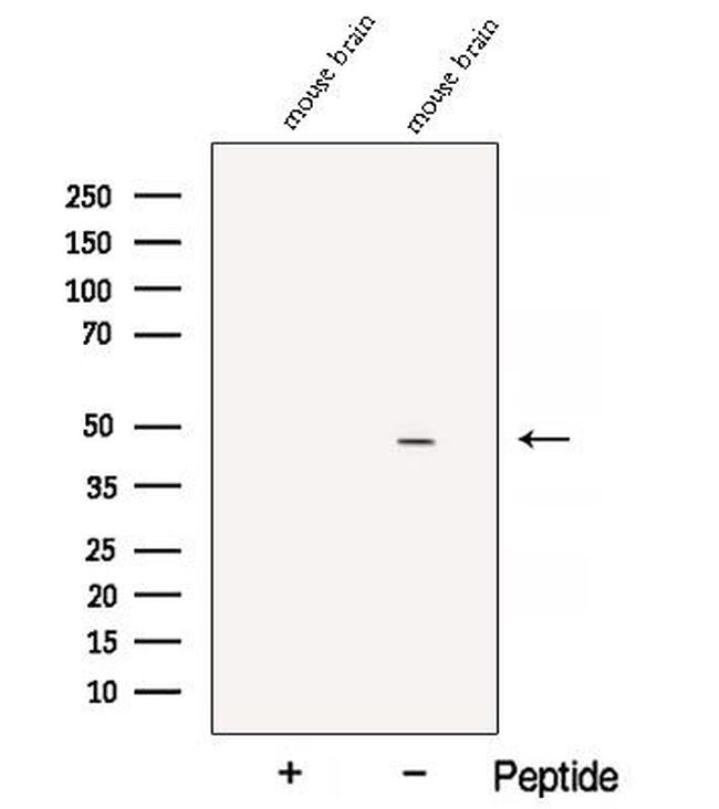 ATP1B2 Antibody in Western Blot (WB)