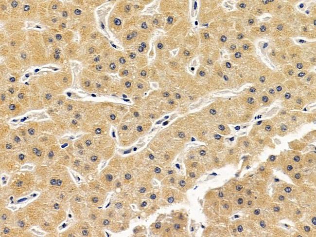 B3GNT3 Antibody in Immunohistochemistry (Paraffin) (IHC (P))