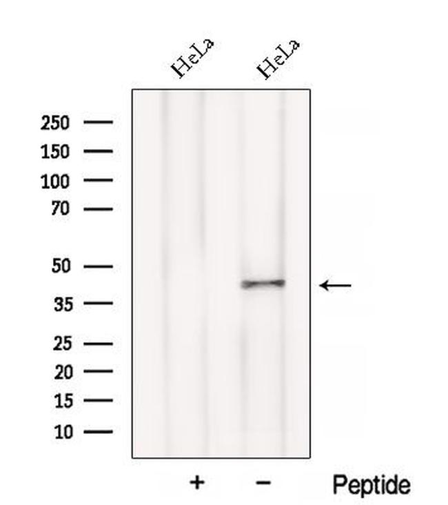 BCAT1 Antibody in Western Blot (WB)