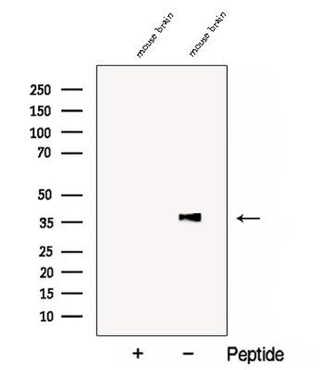 COQ5 Antibody in Western Blot (WB)