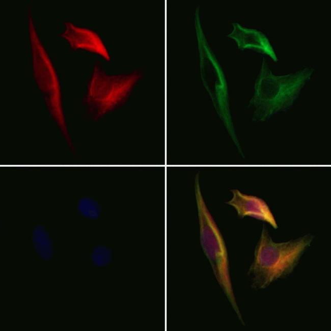 CPNE6 Antibody in Immunocytochemistry (ICC/IF)