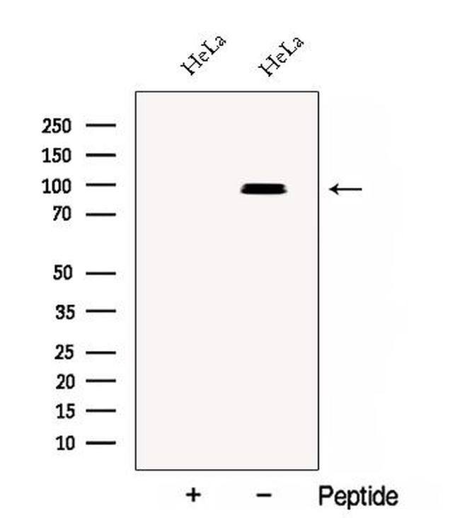 CSDE1 Antibody in Western Blot (WB)