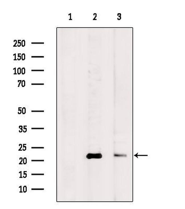 CRP2 Antibody in Western Blot (WB)