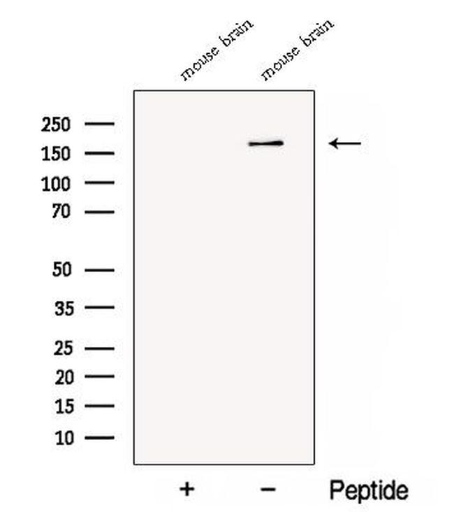 CTTNBP2 Antibody in Western Blot (WB)