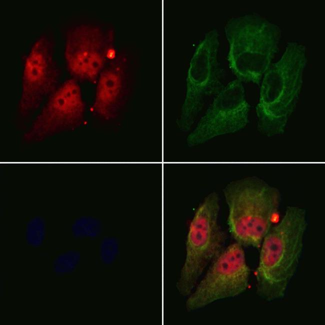 DDX17 Antibody in Immunocytochemistry (ICC/IF)