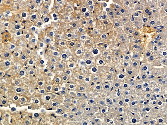 DENR Antibody in Immunohistochemistry (Paraffin) (IHC (P))