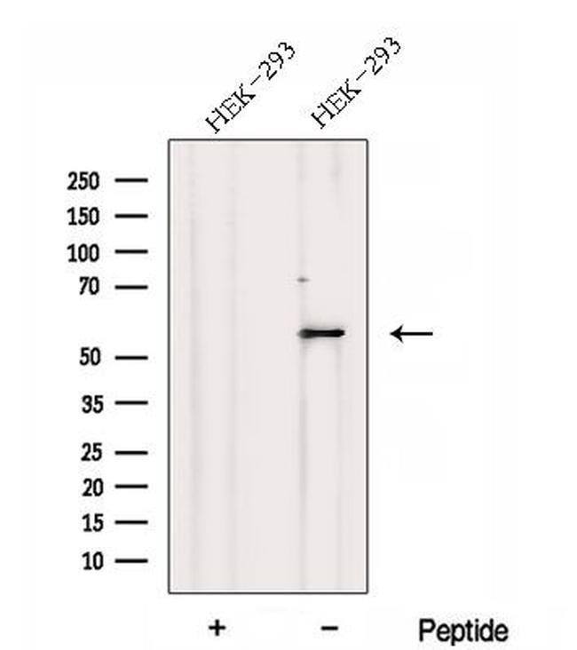 DNPEP Antibody in Western Blot (WB)