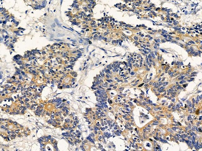 EXOC6 Antibody in Immunohistochemistry (Paraffin) (IHC (P))