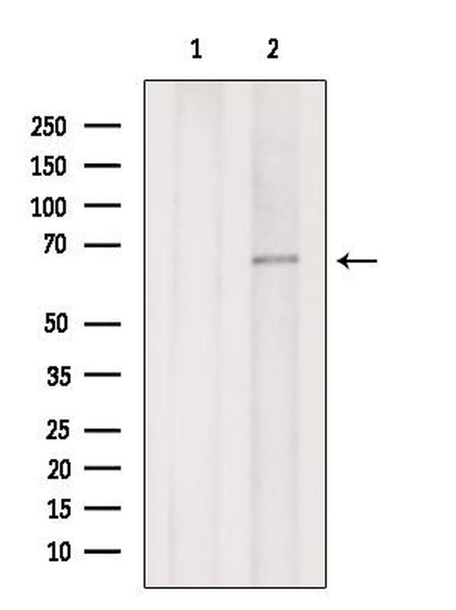 EYA3 Antibody in Western Blot (WB)