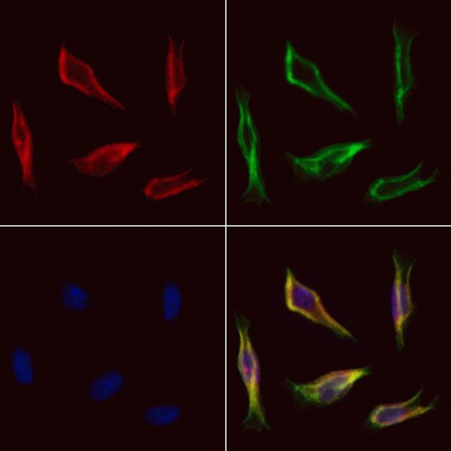 FARS2 Antibody in Immunocytochemistry (ICC/IF)