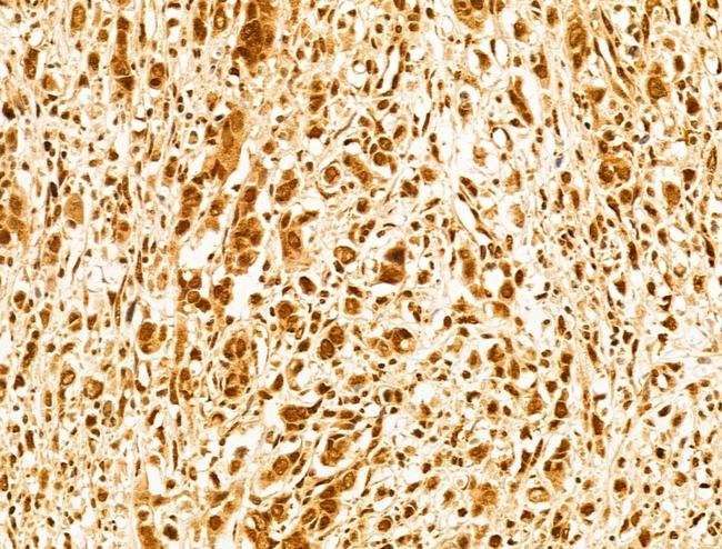 FBXW11 Antibody in Immunohistochemistry (Paraffin) (IHC (P))