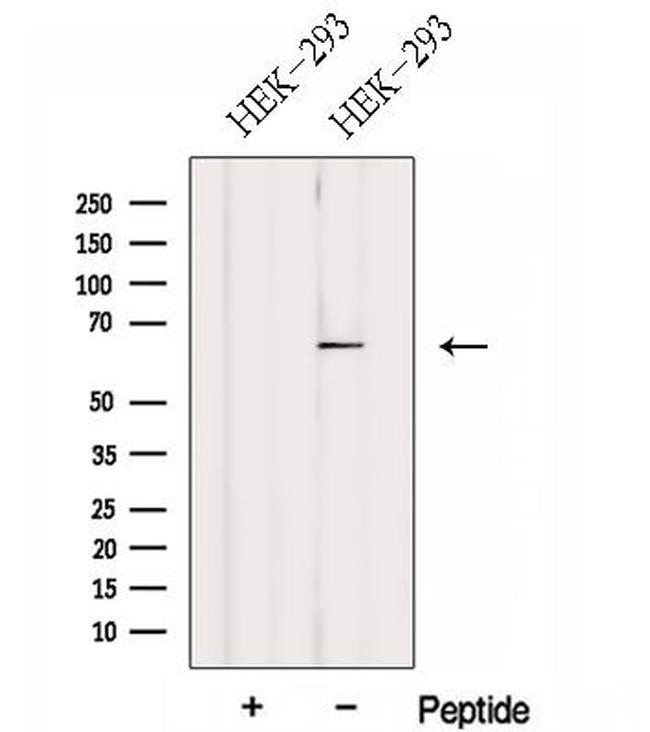 FBXW5 Antibody in Western Blot (WB)