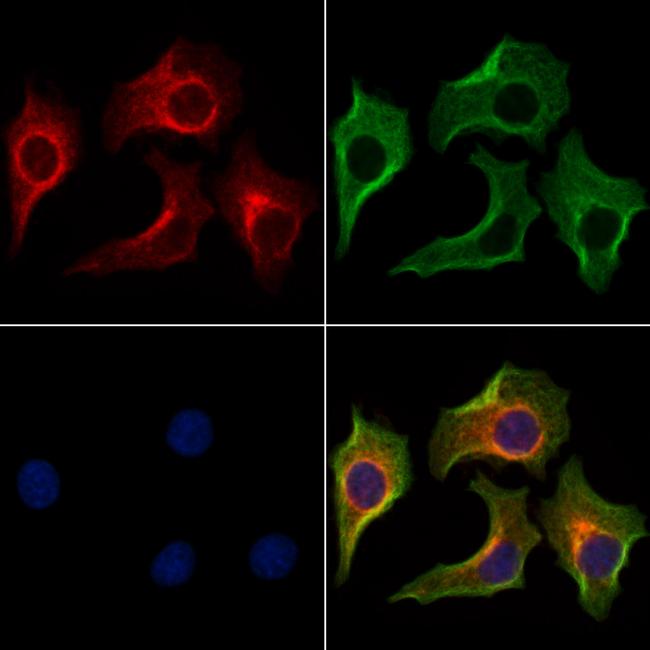 GAMT Antibody in Immunocytochemistry (ICC/IF)