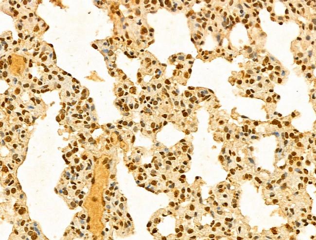 HP1BP3 Antibody in Immunohistochemistry (Paraffin) (IHC (P))