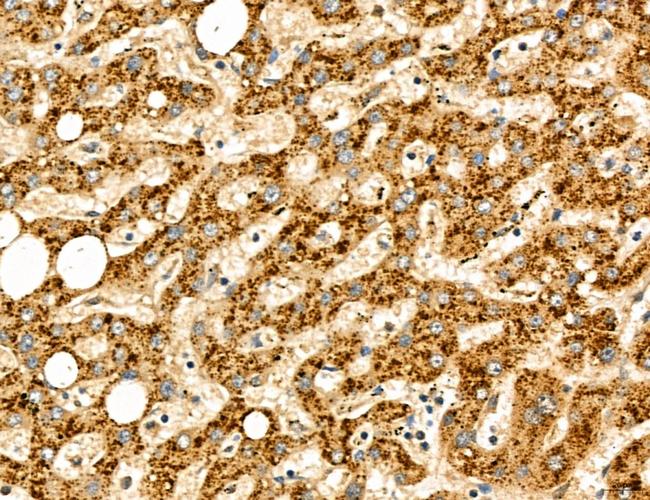 LCA5 Antibody in Immunohistochemistry (Paraffin) (IHC (P))