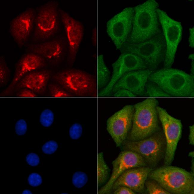 LETM2 Antibody in Immunocytochemistry (ICC/IF)